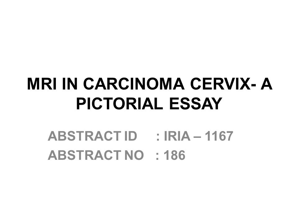 mri in carcinoma cervix a pictorial essay abstract id iria 1167 pictorial essay