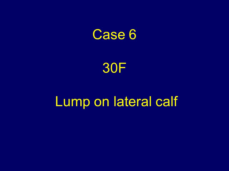 Case 6 30F Lump on lateral calf