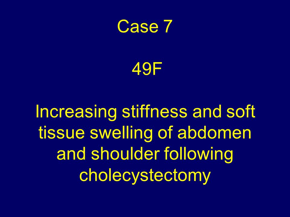 Case 7 49F Increasing stiffness and soft tissue swelling of abdomen and shoulder following cholecystectomy