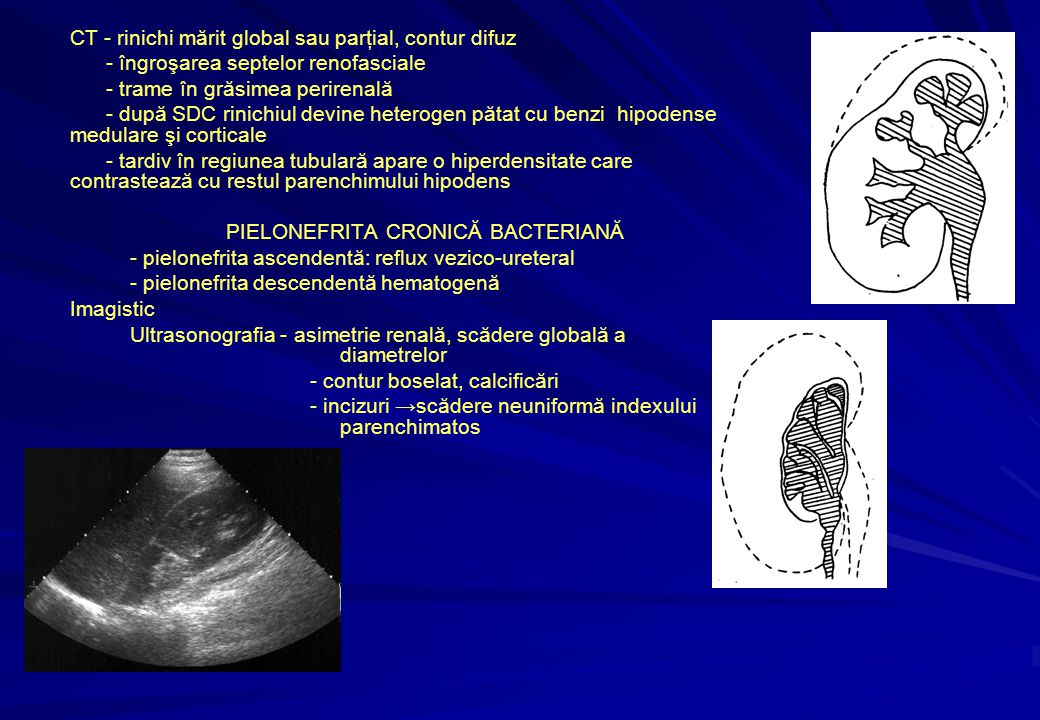 Aparatul reno-urinar Metode examinare -Radiografia renală simplă  -SDC-Urografia intravenoasă (pielografia descendentă), cistografia,  pielografia ascendentă. - ppt download