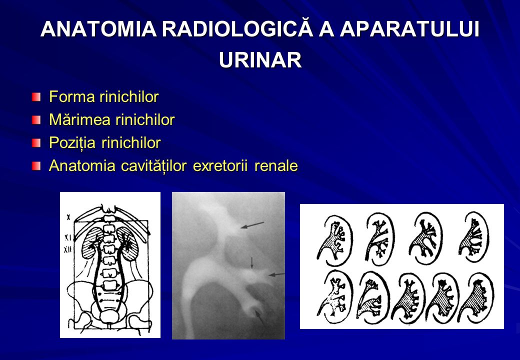 Aparatul reno-urinar Metode examinare -Radiografia renală simplă  -SDC-Urografia intravenoasă (pielografia descendentă), cistografia,  pielografia ascendentă. - ppt download