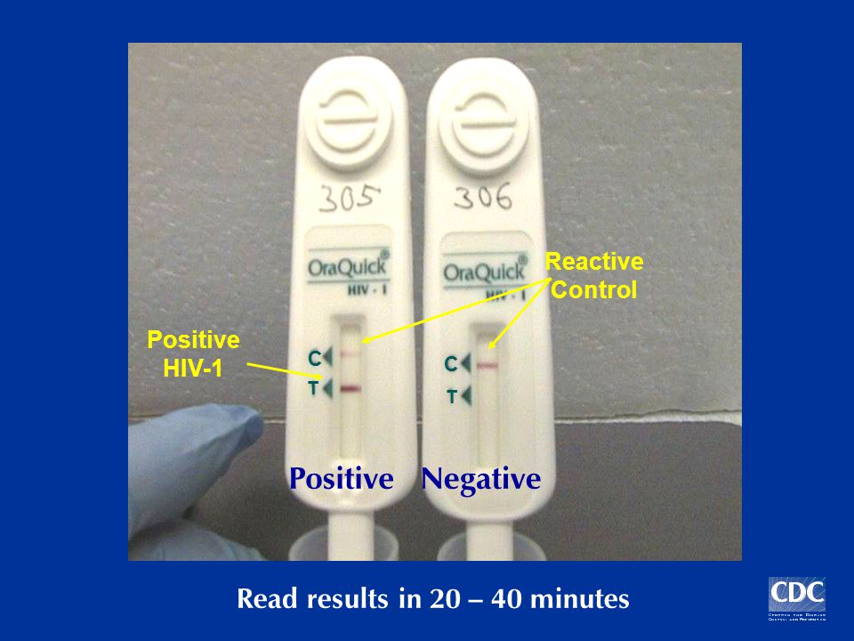 PositiveNegative Reactive Control Positive HIV-1 Read results in 20 – 40 minutes T T C C