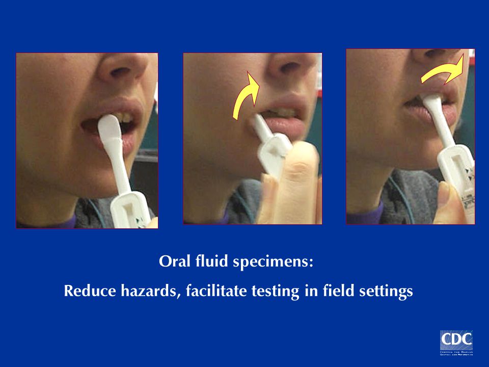 Oral fluid specimens: Reduce hazards, facilitate testing in field settings