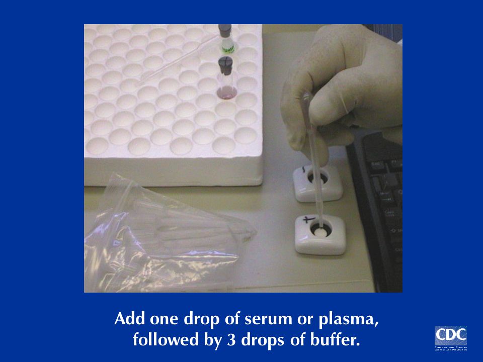 Add one drop of serum or plasma, followed by 3 drops of buffer.