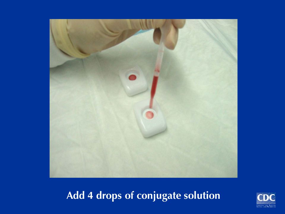 Add 4 drops of conjugate solution