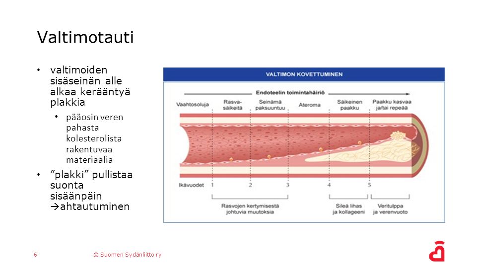 1© Suomen Sydänliitto ry Päivi Ronkainen Terveydenedistäjä TtM SH  Yleiskatsaus sydänsairauksiin. - ppt download