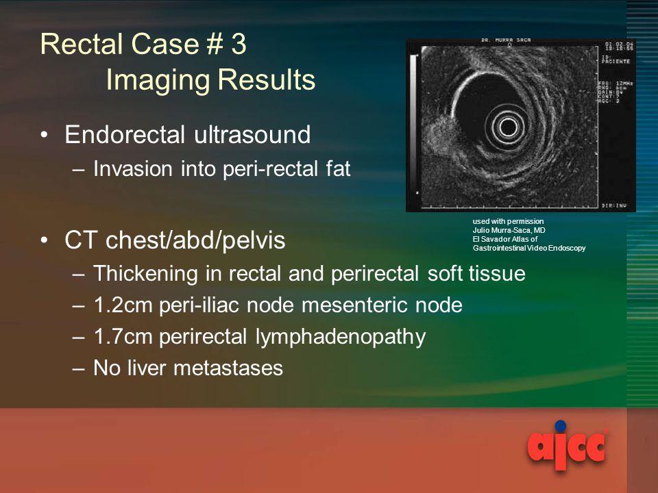Rectal Case # 3 Imaging Results Endorectal ultrasound –Invasion into peri-rectal fat CT chest/abd/pelvis –Thickening in rectal and perirectal soft tissue –1.2cm peri-iliac node mesenteric node –1.7cm perirectal lymphadenopathy –No liver metastases used with permission Julio Murra-Saca, MD El Savador Atlas of Gastrointestinal Video Endoscopy