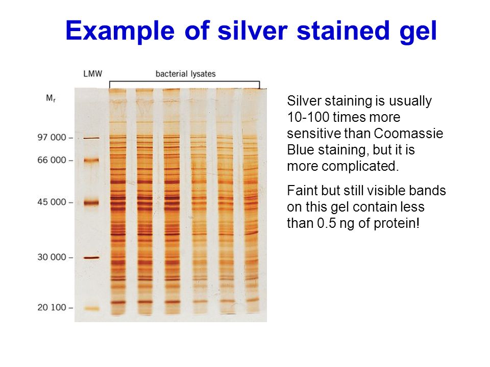 Protein Gel Electrophoresis 1.Native PAGE 2.Native Gradient PAGE 3.Urea  PAGE 4.SDS PAGE 5.SDS Gradient PAGE 6.IEF 7.2D PAGE 8.Western Blot. - ppt  download