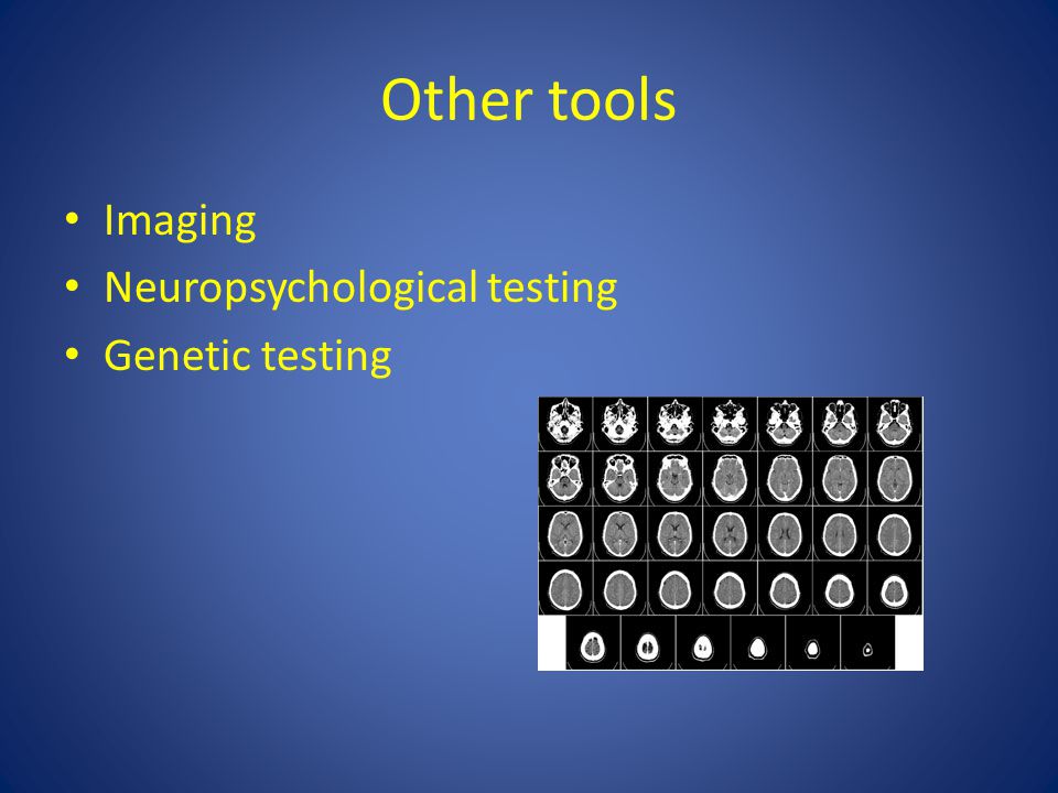 Other tools Imaging Neuropsychological testing Genetic testing