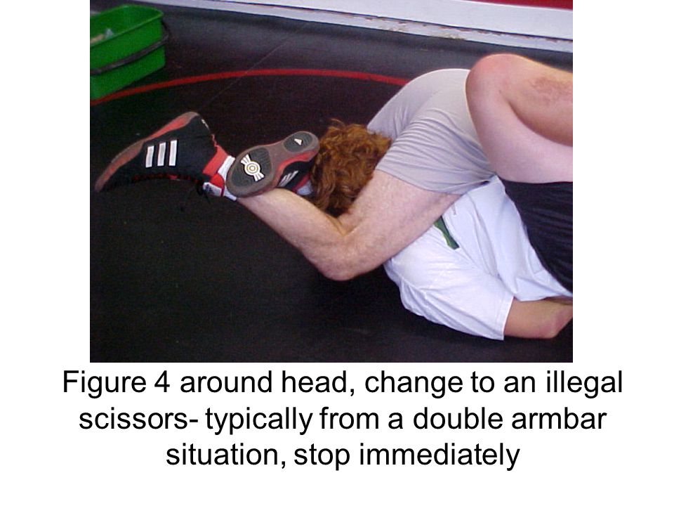 Figure 4 around head, change to an illegal scissors- typically from a doubl...