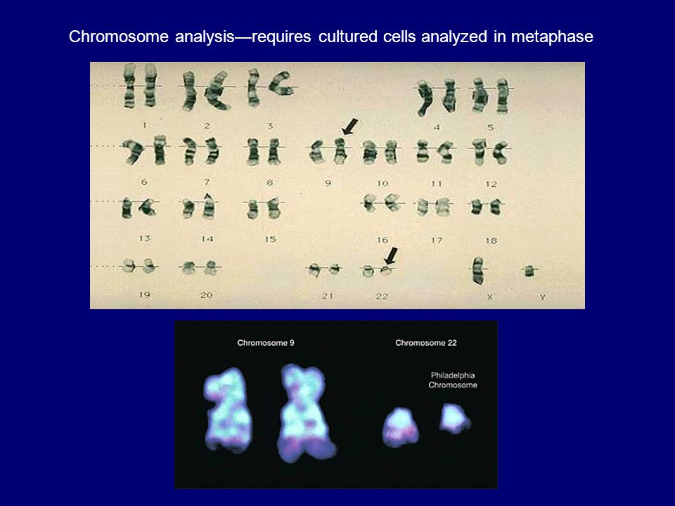 Chromosome analysis—requires cultured cells analyzed in metaphase