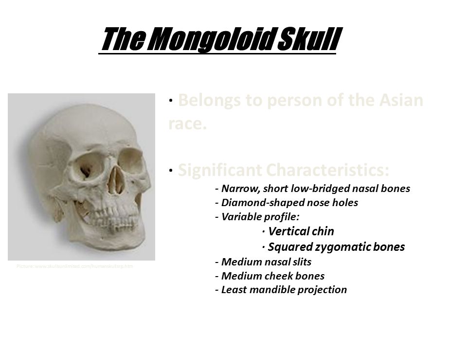 Skeletal Identification Still Needs Work Identifying The Race Of A Skull Forensic Anthropologists Identify Unidentified Skeletal Remains By Studying Ppt Download