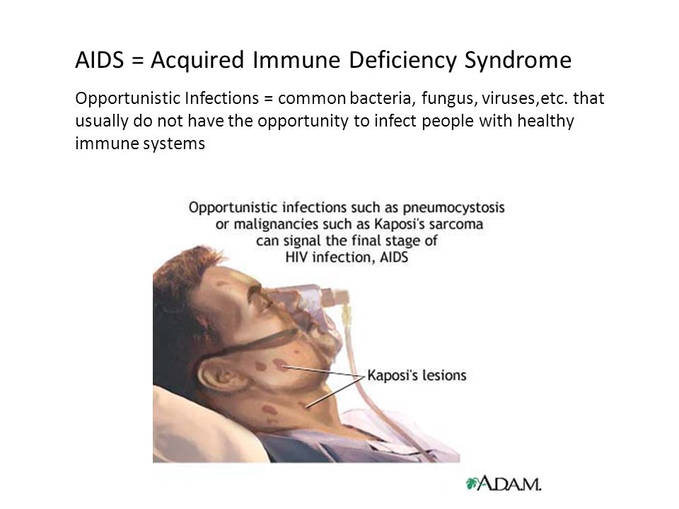 AIDS = Acquired Immune Deficiency Syndrome Opportunistic Infections = common bacteria, fungus, viruses,etc.