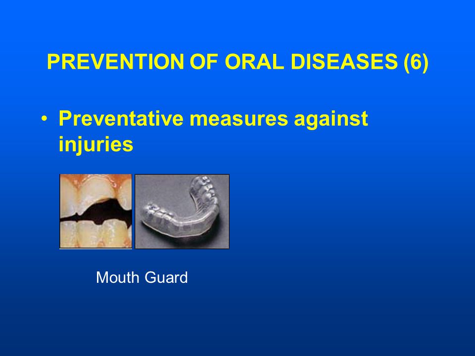 PREVENTION OF ORAL DISEASES (6) Preventative measures against injuries Mouth Guard
