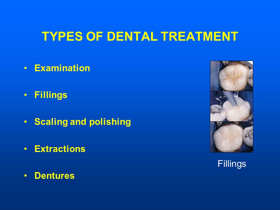 TYPES OF DENTAL TREATMENT Examination Fillings Scaling and polishing Extractions Dentures Fillings
