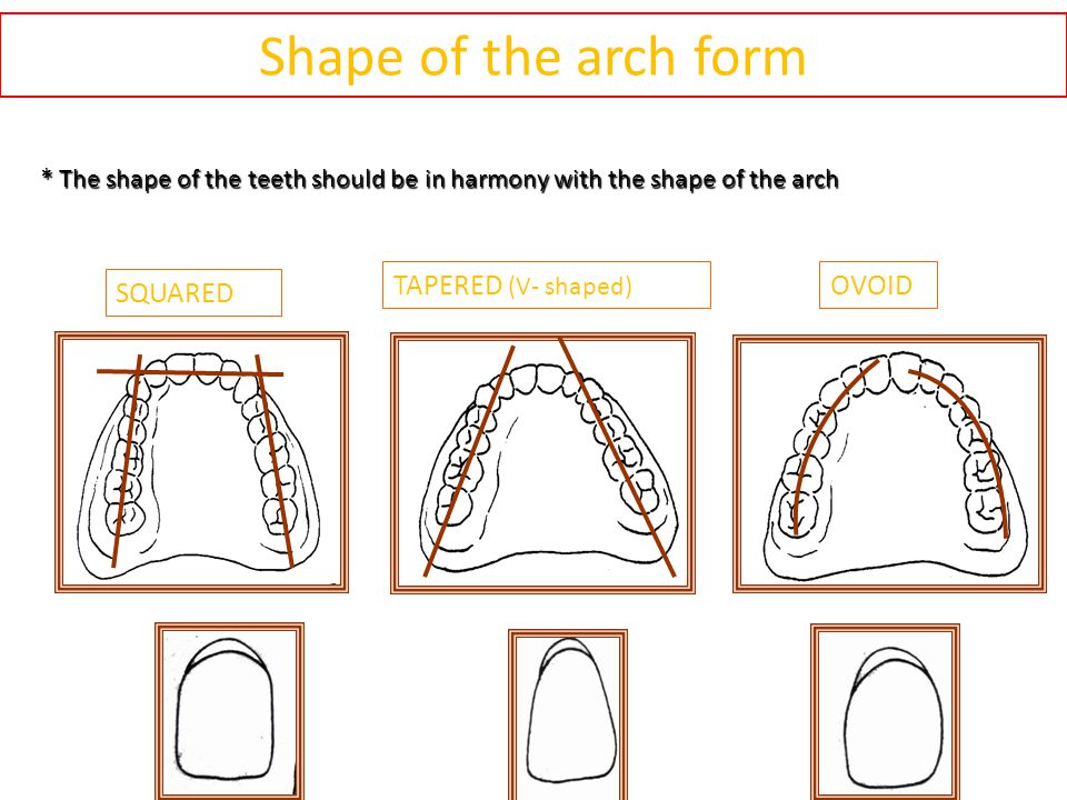 SELECTION OF ANTERIOR TEETH.. 1.LENGTH THE HEIGHT OF OCCLUSAL ...