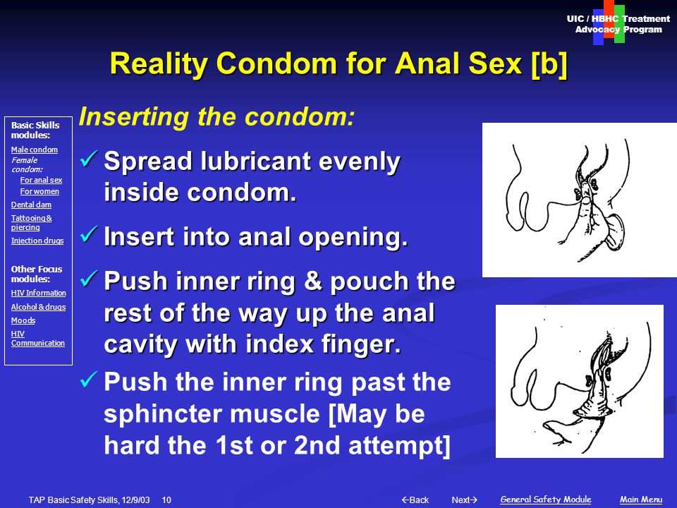Condiloame genitale - Medic Info Condilom anus