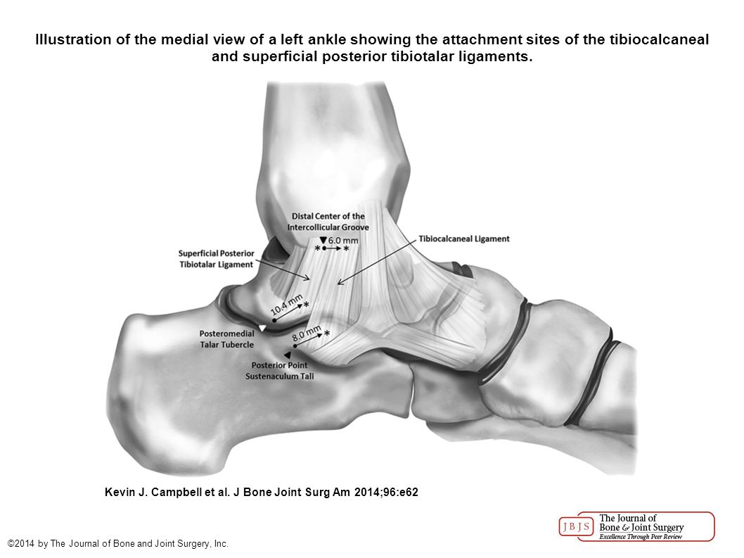 JBJS: The Ligament Anatomy of the Deltoid Complex of the Ankle: A  Qualitative and Quantitative Anatomical Study