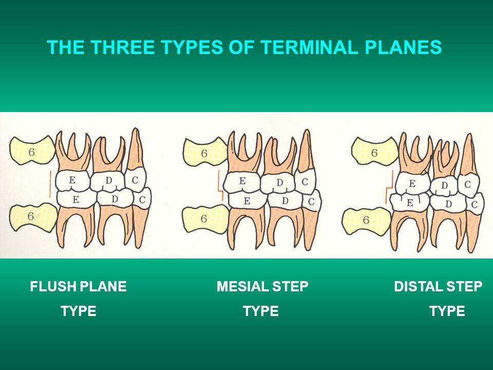 Isfahan Dental School Pediatric Dentistry Departement Dr S E Jabbarifar Ppt Download