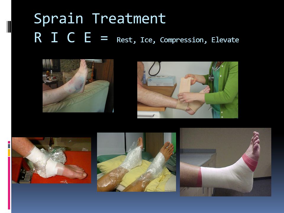 Sprain Treatment R I C E = Rest, Ice, Compression, Elevate