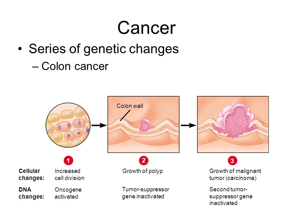 Cancer Series of genetic changes –Colon cancer Colon wall Cellular changes: DNA changes: 1 Increased cell division Oncogene activated 2 Growth of polyp Tumor-suppressor gene inactivated 3 Growth of malignant tumor (carcinoma) Second tumor- suppressor gene inactivated
