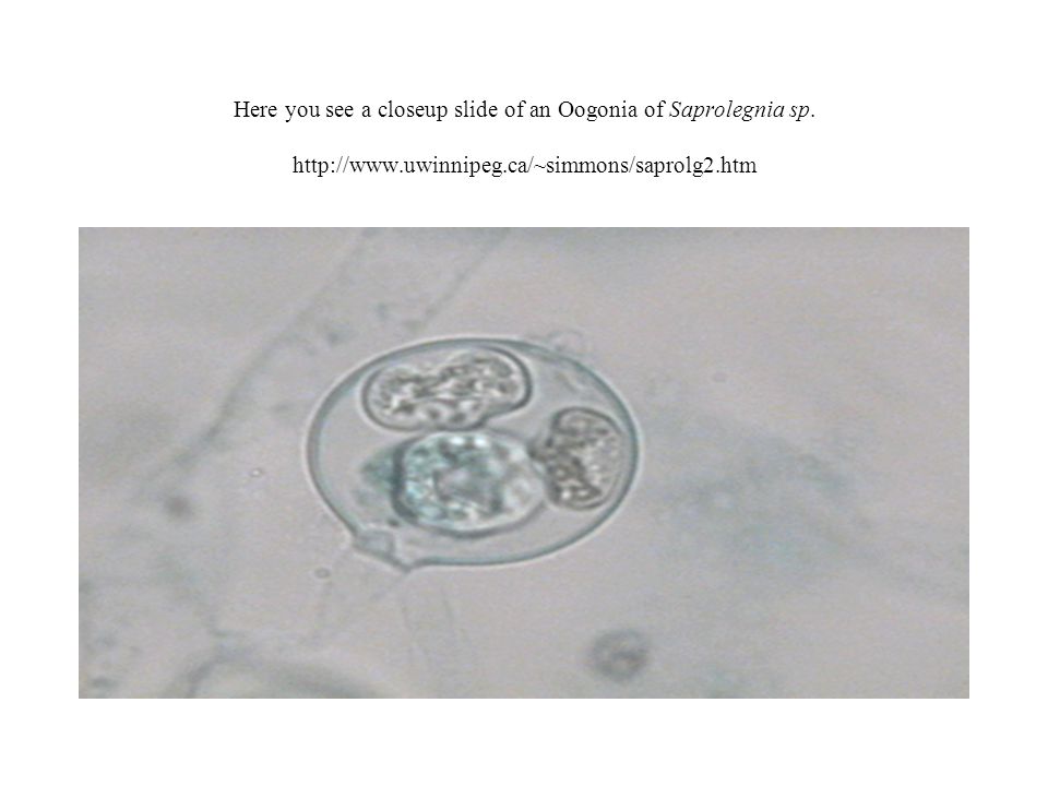 Here you see a closeup slide of an Oogonia of Saprolegnia sp.