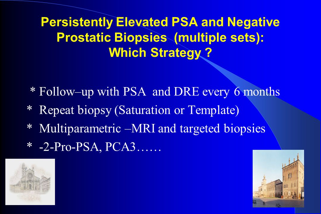 adenocarcinoma prostatico 4 50