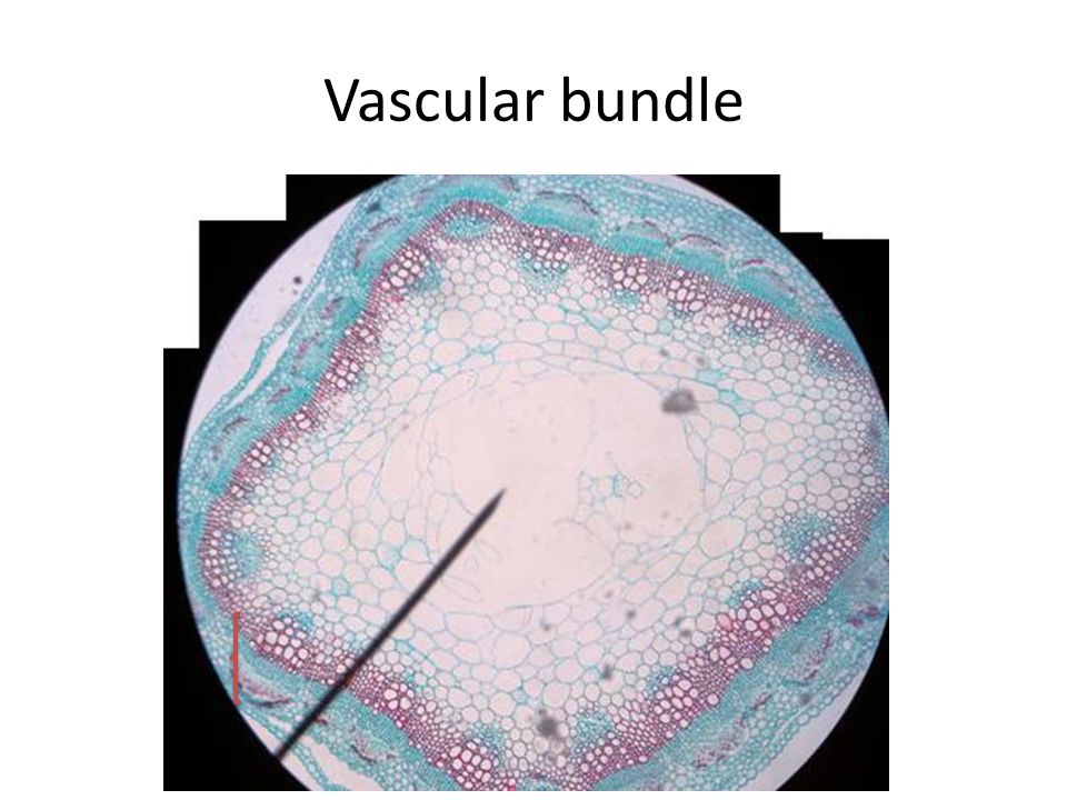 Vascular bundle