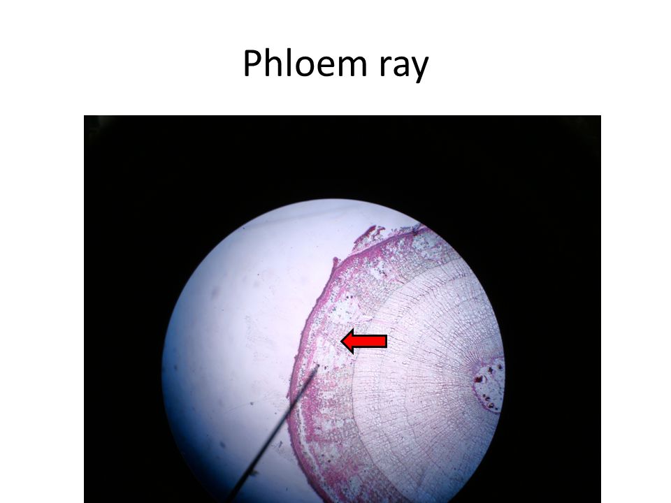 Phloem ray
