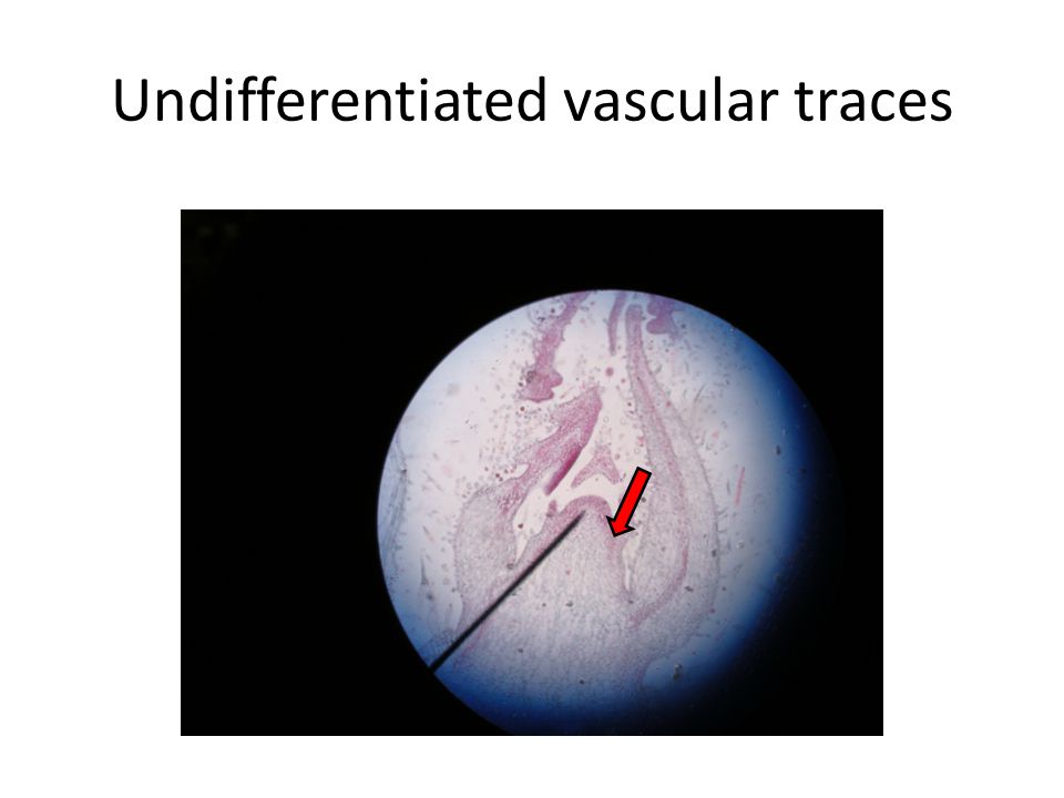Undifferentiated vascular traces