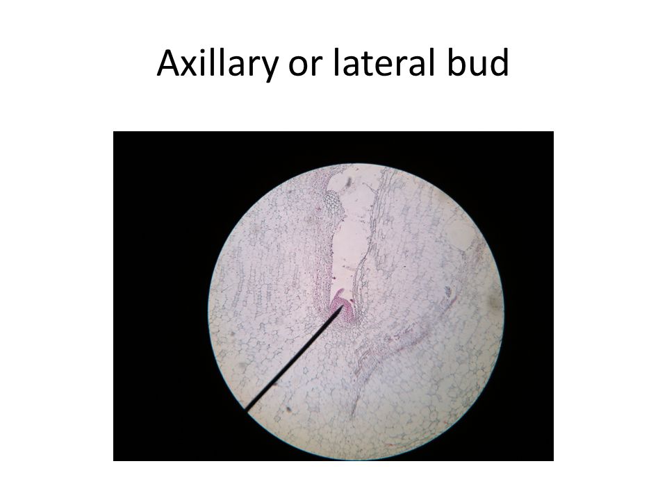 Axillary or lateral bud