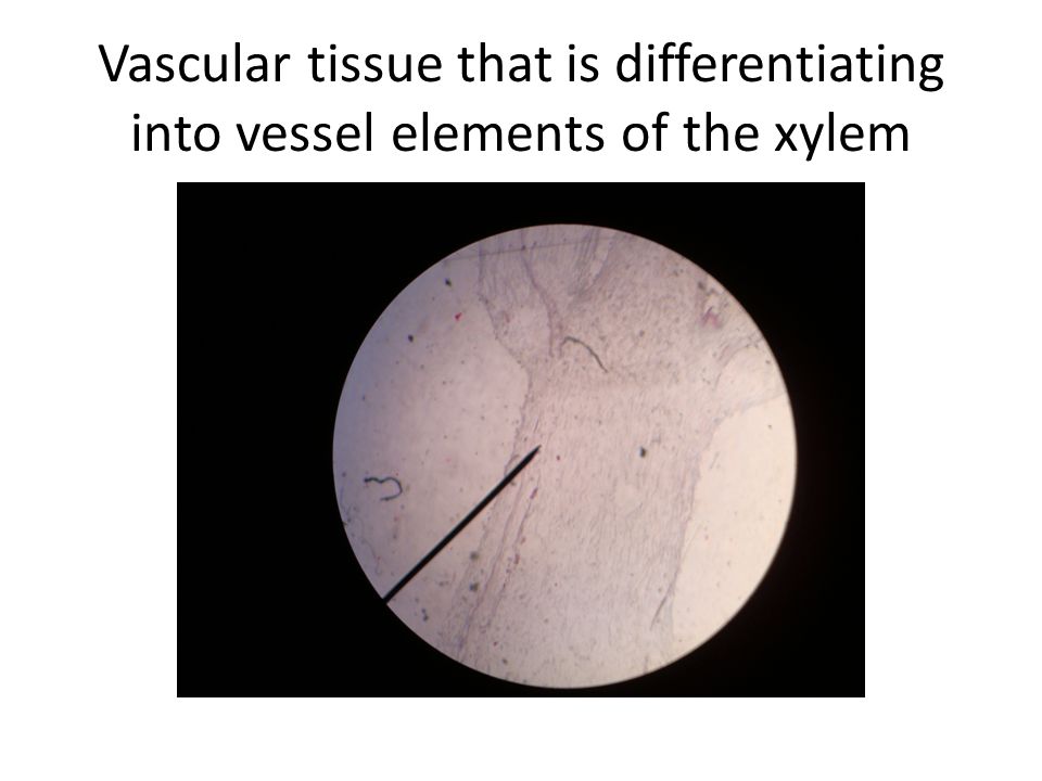 Vascular tissue that is differentiating into vessel elements of the xylem