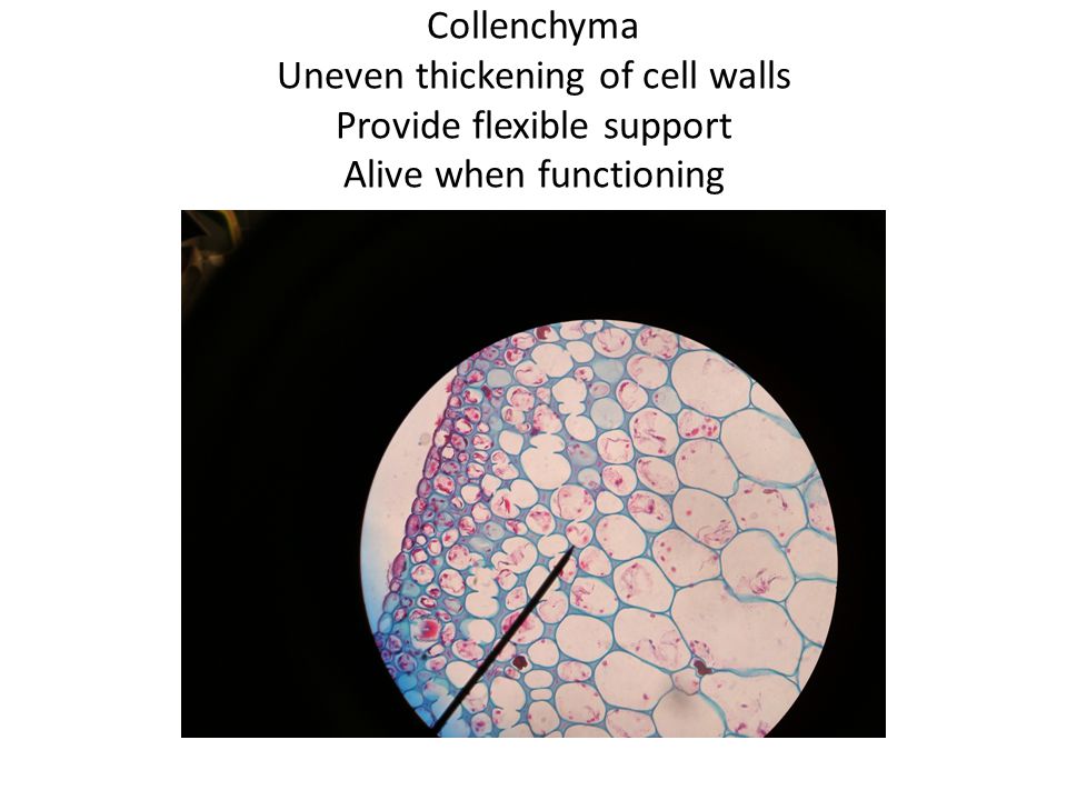 Collenchyma Uneven thickening of cell walls Provide flexible support Alive when functioning