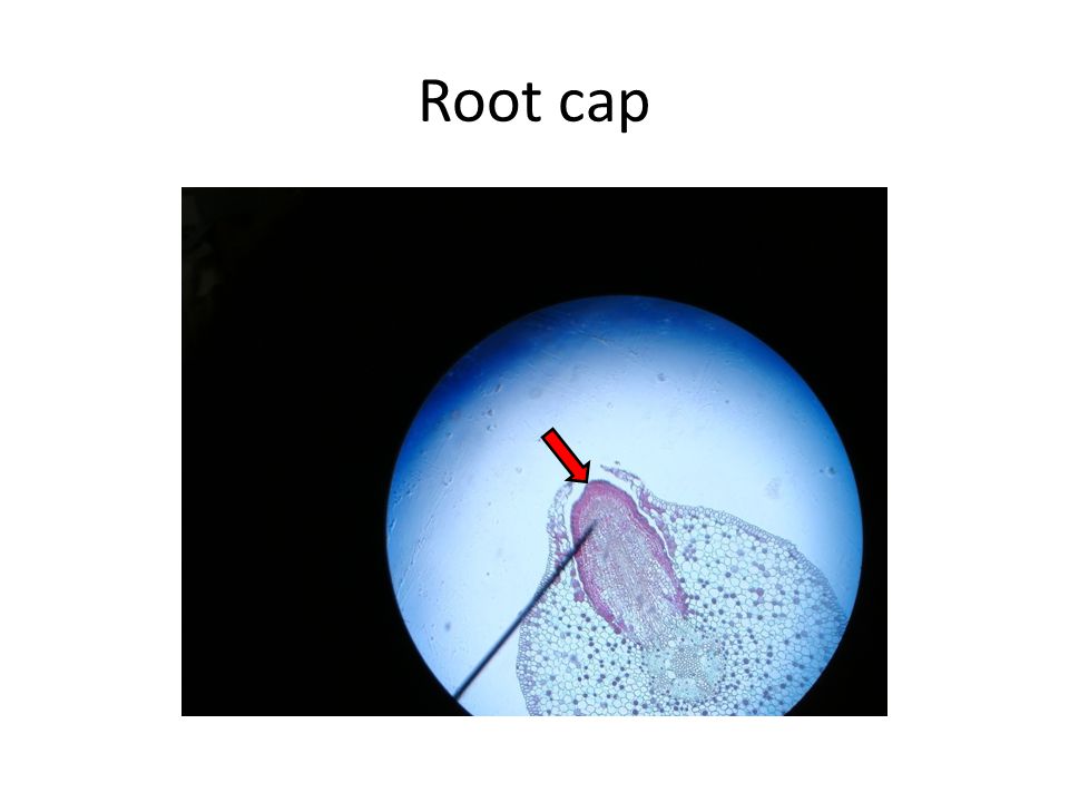 Root cap