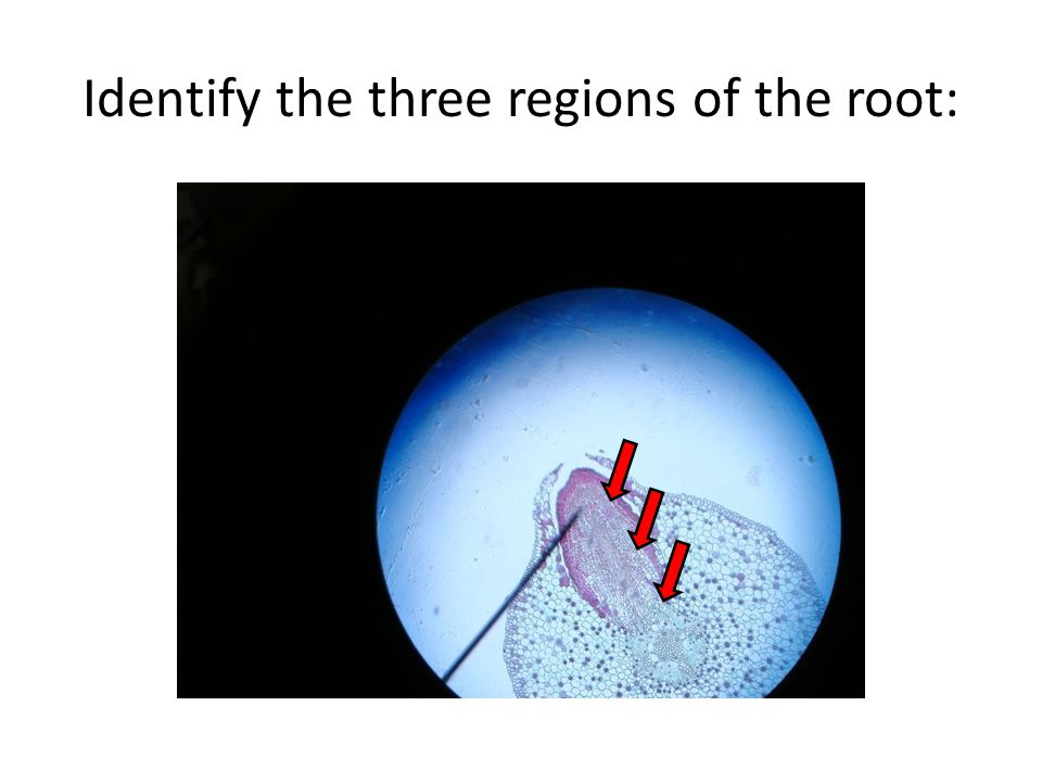 Identify the three regions of the root:
