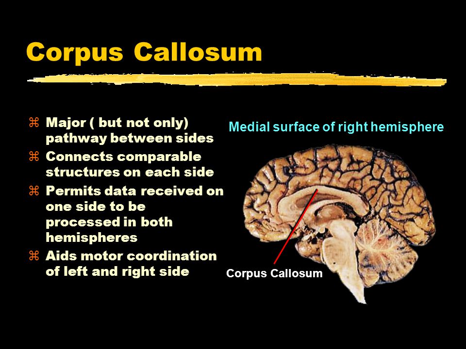 Corpus Callosum zMajor ( but not only) pathway between sides zConnects comparable structures on each side zPermits data received on one side to be processed in both hemispheres zAids motor coordination of left and right side Corpus Callosum Medial surface of right hemisphere