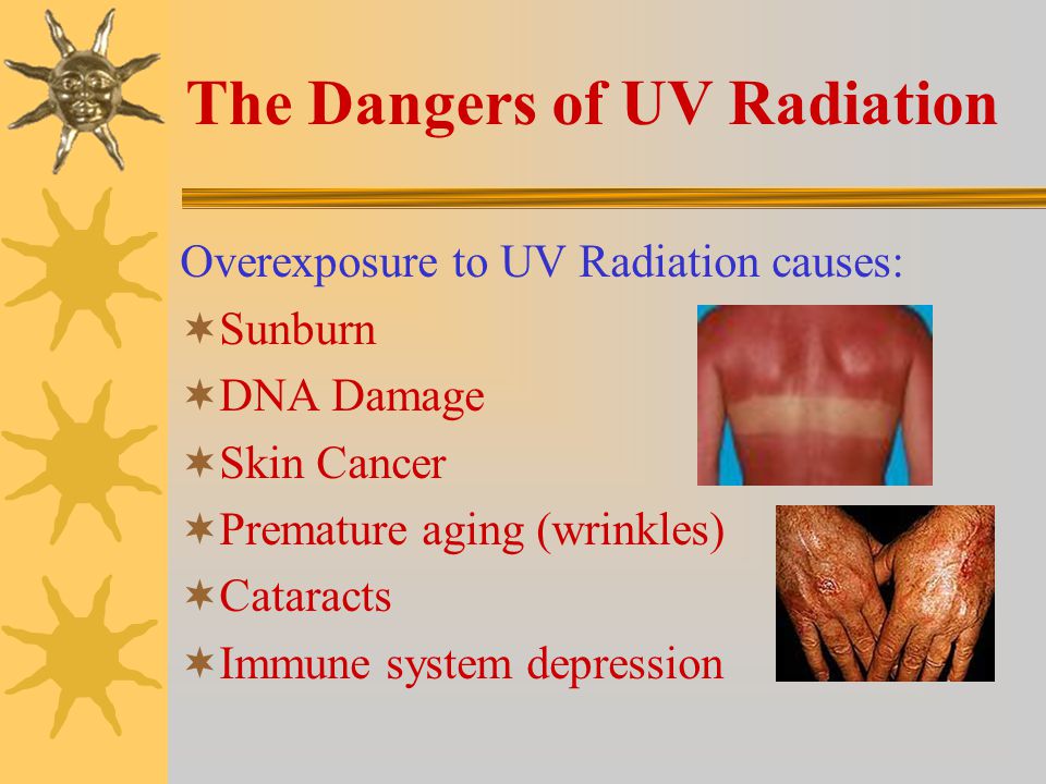 Ultraviolet Light or UV Radiation