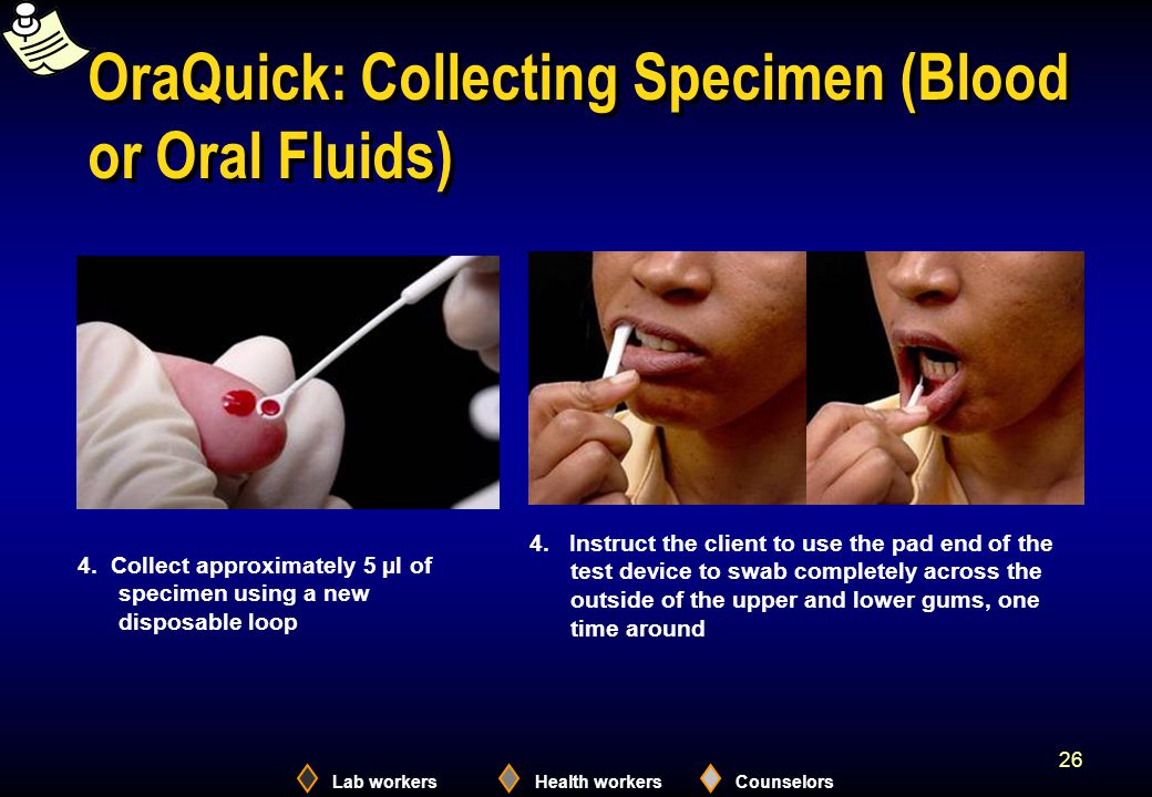Lab workersHealth workersCounselors 26 OraQuick: Collecting Specimen (Blood or Oral Fluids) 4.