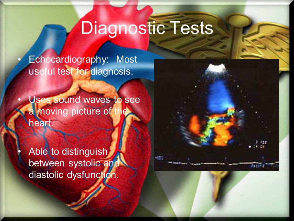 Diagnostic Tests Echocardiography: Most useful test for diagnosis.