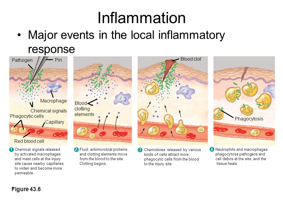 Inflammation Major events in the local inflammatory response Figure 43.6 Pathogen Pin Macrophage Chemical signals Capillary Phagocytic cells Red blood cell Blood clotting elements Blood clot Phagocytosis Fluid, antimicrobial proteins, and clotting elements move from the blood to the site.