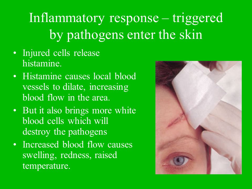 Inflammatory response – triggered by pathogens enter the skin Injured cells release histamine.