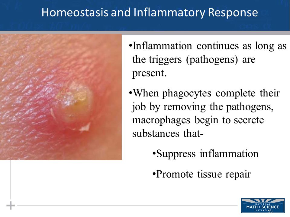 23 Homeostasis and Inflammatory Response Inflammation continues as long as the triggers (pathogens) are present.