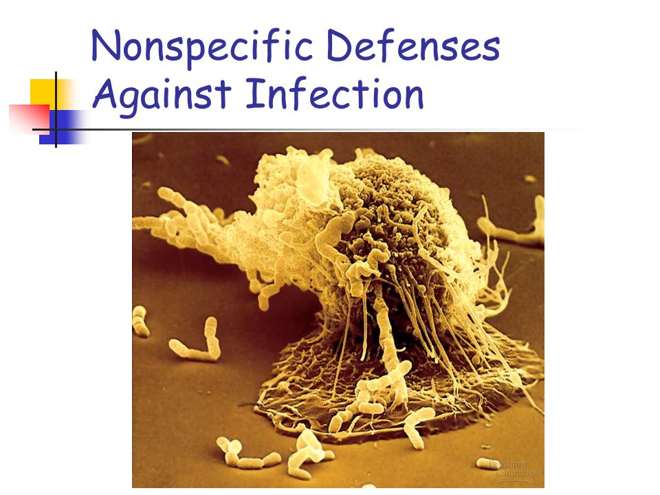 Nonspecific Defenses Against Infection