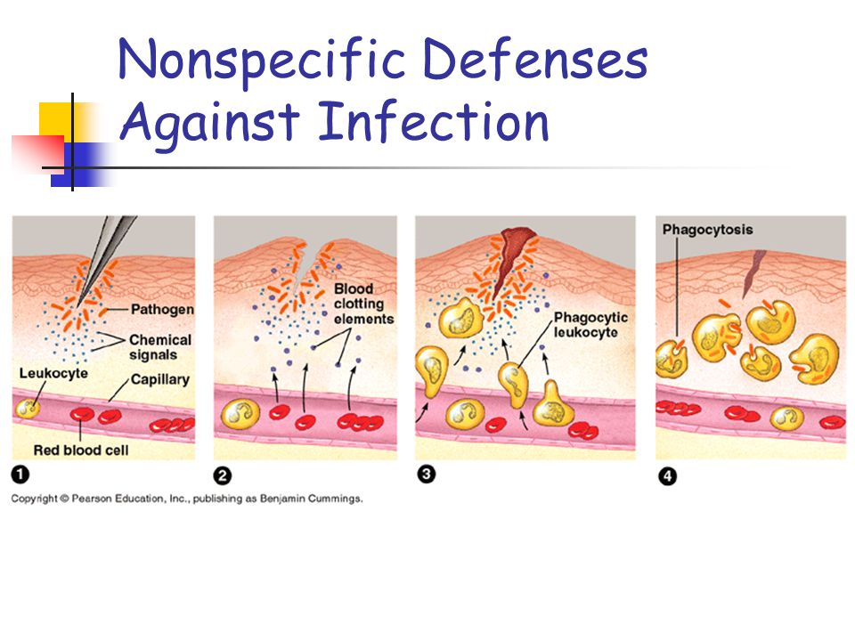 Nonspecific Defenses Against Infection