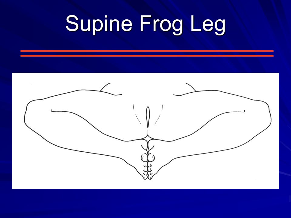 frog leg position examination