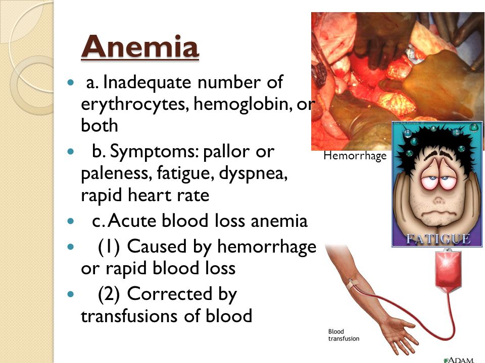 Cardiovascular Diseases and Abnormal Conditions. Anemia a ...