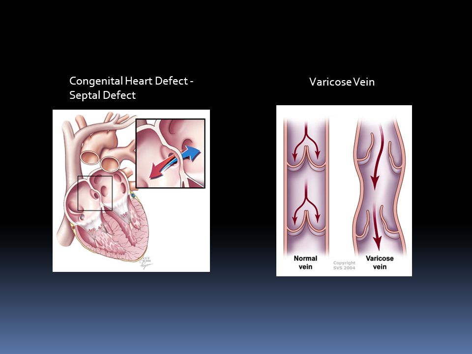 Cardiovascular System Problems  Congenital Heart Defects – heart conditions that are present at birth.