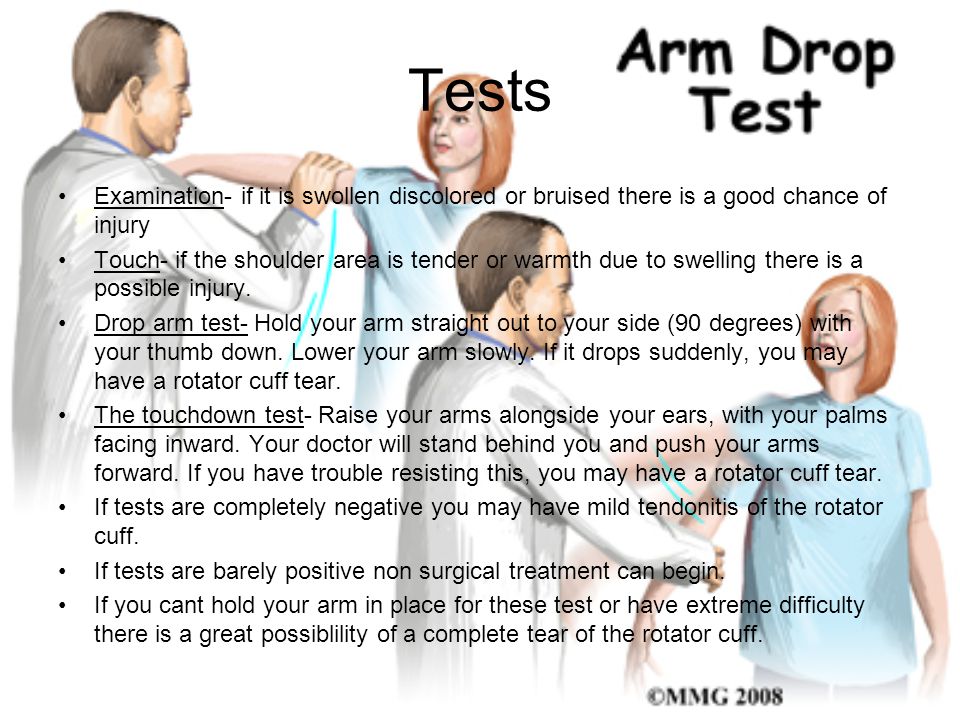 torn rotator cuff test