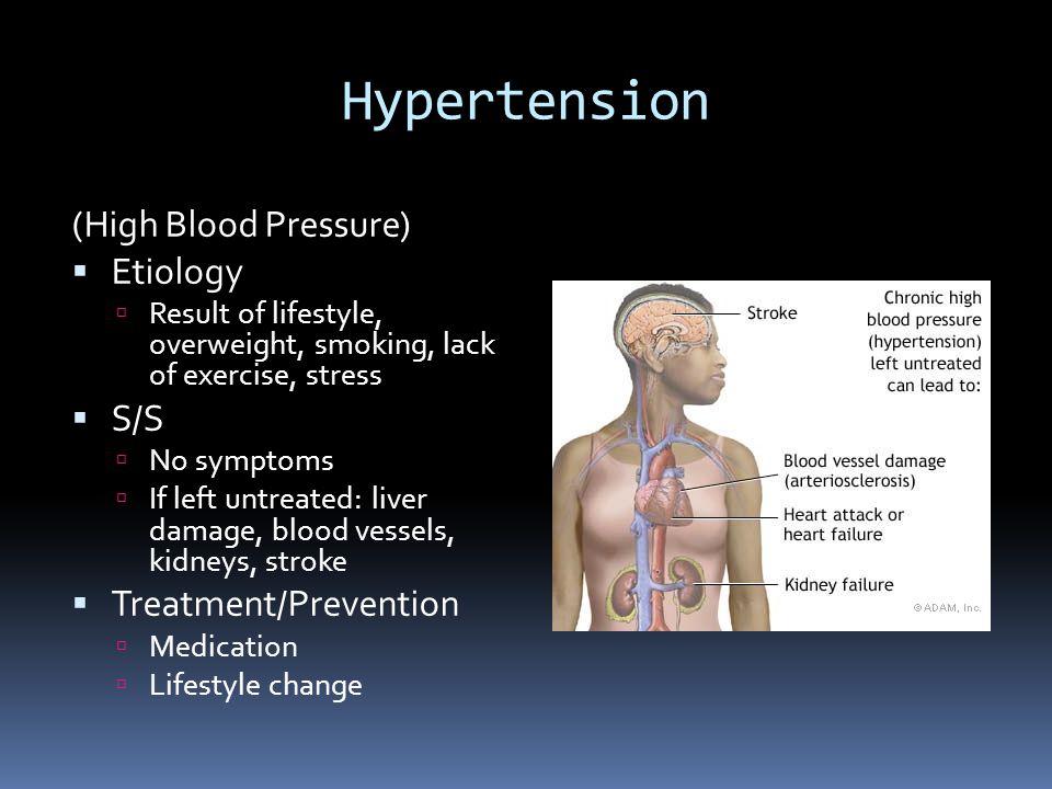 Hypertension (High Blood Pressure)  Etiology  Result of lifestyle, overweight, smoking, lack of exercise, stress  S/S  No symptoms  If left untreated: liver damage, blood vessels, kidneys, stroke  Treatment/Prevention  Medication  Lifestyle change