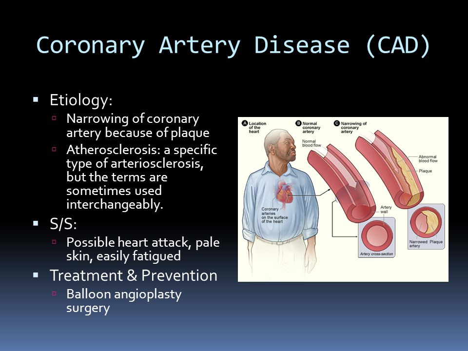 Coronary Artery Disease (CAD)  Etiology:  Narrowing of coronary artery because of plaque  Atherosclerosis: a specific type of arteriosclerosis, but the terms are sometimes used interchangeably.